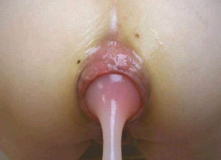 アナル,ウナギ,異物挿入,エロ画像