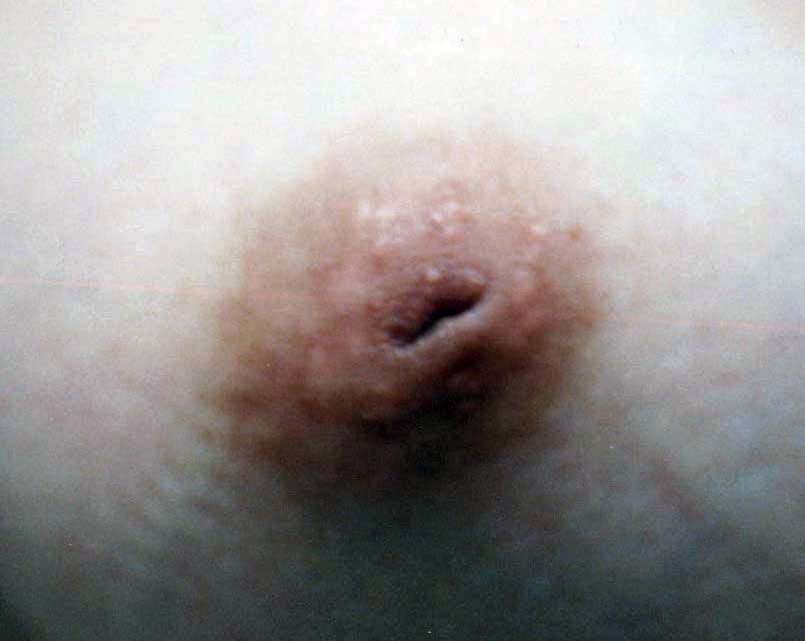 乳輪,陥没乳首,エロ画像