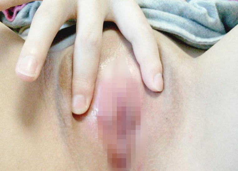 ハタチのイケメンOLがTwitterでつるつるに剃ったパイパンマ●コをくぱぁ鏡撮り