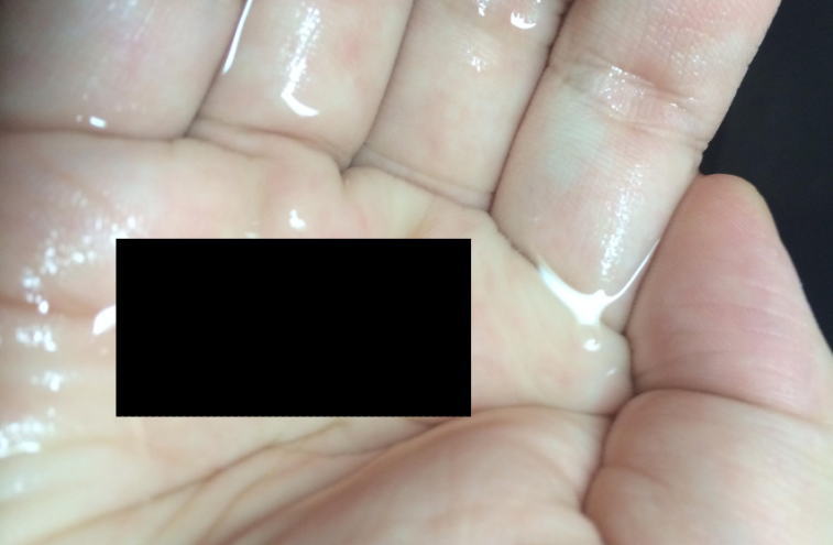 【グロ注意】生理中に子宮から出たモノを写メってうpした女！！！！！